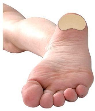 Premium Adhesive Moleskin Kidney Metatarsal Pads - 3.5"